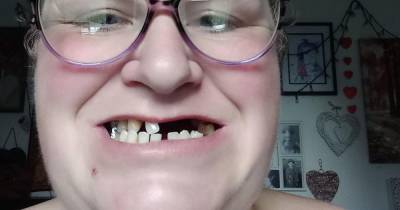 Mum forced to pull out 11 of her own teeth after not being able to find a dentist - www.manchestereveningnews.co.uk