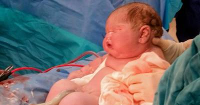 Mum gives birth to huge 14lb 15oz baby believed to be UK's 3rd biggest ever newborn - www.dailyrecord.co.uk - Britain