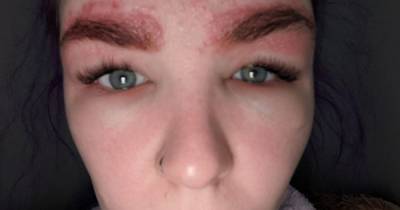 Mum told she could have DIED after horrific allergic reaction to eyebrow tint - www.manchestereveningnews.co.uk