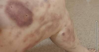 Scots dog owner savaged by new puppy and left with horror injuries - www.dailyrecord.co.uk - Scotland - Germany - Belgium
