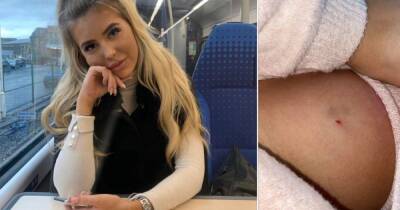 Young woman fears she was spiked with needle while visiting Manchester's Christmas Markets - she 'won't be going out again for a long time' after blacking out - www.manchestereveningnews.co.uk - Manchester