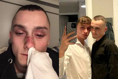 Gay couple beaten with hammer and robbed by gang after holding hands - www.metroweekly.com - Britain - Manchester