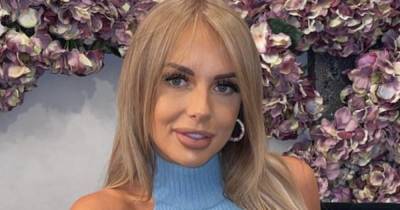 Love Island’s Faye compared to Killing Eve’s Jodie Comer after dissolving lip filler - www.ok.co.uk