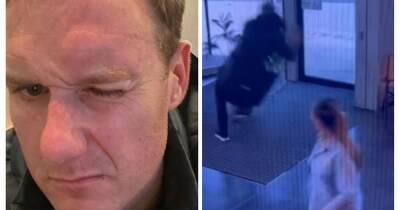 Strictly's Dan Walker rushed to hospital for brain scan after running into glass door - www.manchestereveningnews.co.uk