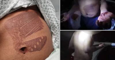 Shocking video shows horrific injuries suffered by man kidnapped and tortured by trio - www.manchestereveningnews.co.uk