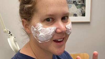 Amy Schumer Just Got Her Fillers Removed: ‘Thank God You Can Dissolve Them’ - www.glamour.com
