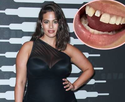 Ashley Graham Shares PAINFUL Photo Of Broken Tooth After Son Headbutts Her! - perezhilton.com