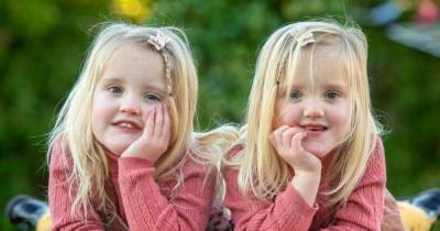 Scots twins like 'two sides of the same coin' are 'mirror image' of each other - www.dailyrecord.co.uk - Scotland