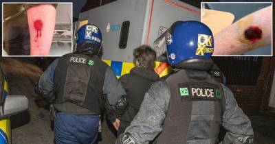 The bite marks inflicted on cops who stormed homes and arrested six after gang war shootings rock north Manchester - www.manchestereveningnews.co.uk - Manchester