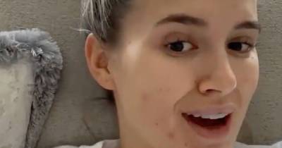 Molly-Mae Hague shares reality of suffering from painful acne as she posts make up free clip - www.ok.co.uk - Hague