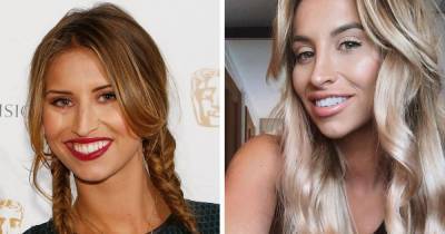 Ferne McCann’s dentist shares exactly what work the TOWIE star has had done to her teeth - www.ok.co.uk