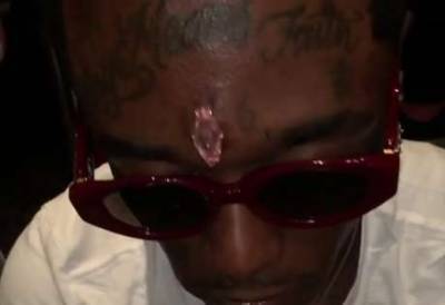 Weird story of the week: rapper Lil Uzi Vert has $24 million pink diamond surgically implanted in his forehead - www.msn.com