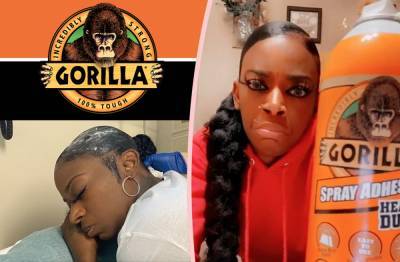 'It Started To Burn': Gorilla Glue Girl Tells Full Horror Story In First Interview -- Will She Sue?? - perezhilton.com - state Louisiana - county Story