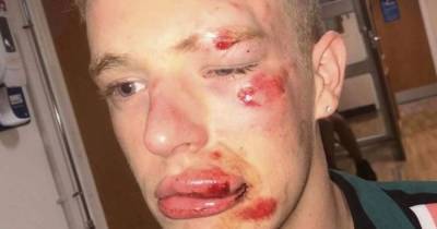 'You all need to die': Gay Village worker punched unconscious in brutal homophobic attack - but thug walked free - www.manchestereveningnews.co.uk - county Preston