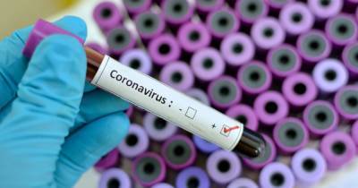 People infected with coronavirus 'could still catch Brazil variant', expert warns - www.dailyrecord.co.uk - Britain - Brazil - Scotland