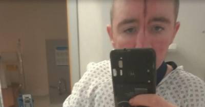 Brutal Glasgow swordfight victim shares horror hospital image of huge face scar - www.dailyrecord.co.uk