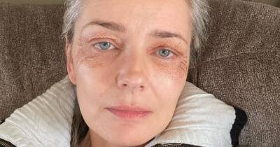 Paulina Porizkova, 55, Shows Off Puncture Marks From Anti-Aging Treatment: ‘I’m Vain and Want to Be Pretty’ - www.usmagazine.com