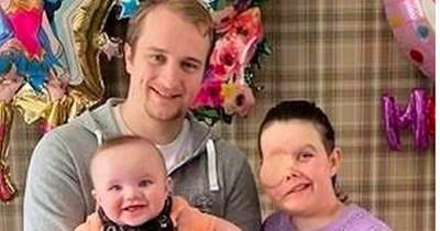 Young Scots mum fighting rare form of nasal cancer given just months to live - www.dailyrecord.co.uk - Scotland - county Young