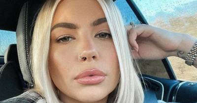 Olivia Bowen praised by fans for showing her psoriasis but what is the skin condition and how do you treat it - www.ok.co.uk