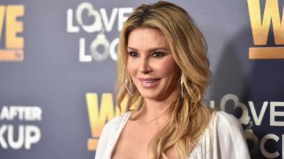 Brandi Glanville recovering from second-degree burns after psoriasis treatment mishap - www.foxnews.com