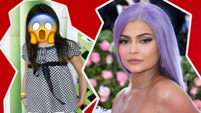Kylie Jenner before and after plastic surgery - heatworld.com