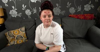 'Nobody is listening' Tormented Scots teen begs medics to save her after being sent home from hospital following suicide attempts - www.dailyrecord.co.uk - Scotland