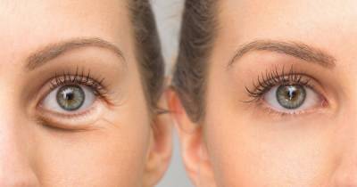 This Hydrating Eye Cream May Reduce Dark Circles After Just 3 Days of Use - www.usmagazine.com