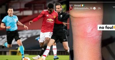 Amad fumes posting injury update after Manchester United win over Granada - www.manchestereveningnews.co.uk - Manchester - Ivory Coast