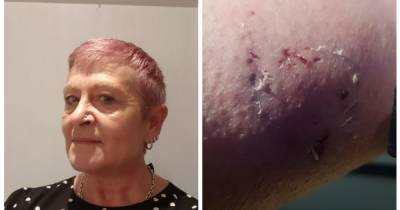 'He was off his face'.... coach-driving gran violently attacked by 'little toerag' after she refused to take him to his Liverpool home - www.manchestereveningnews.co.uk - county Hyde