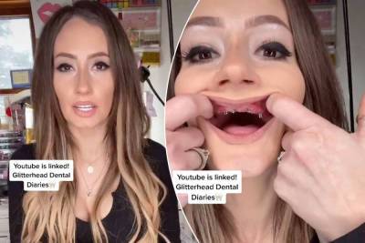 Mom, 36, pops dentures on TikTok, goes viral for reducing stigma - nypost.com - New York