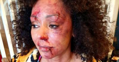 Mel B is bruised and beaten in devastating Women's Aid domestic violence video inspired by her own life - www.ok.co.uk