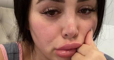 Marnie Simpson says she 'owes life' to fiancé Casey Johnson as she 'wanted to die' over bladder condition - www.ok.co.uk