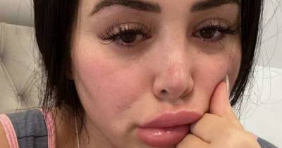 Marnie Simpson says she 'owes life' to fiancé Casey Johnson as she 'wanted to die' over bladder condition - www.msn.com