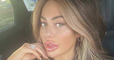 Chloe Ferry plans third nose job after previous 'botched' op left her feeling 'insecure' when taking pictures - www.ok.co.uk