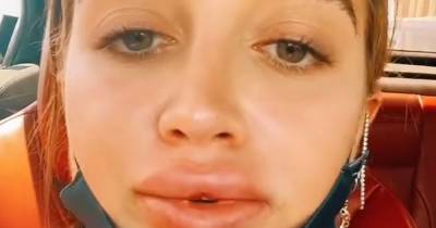 Georgia Harrison undergoes huge transformation as she has her lip filler removed - www.ok.co.uk