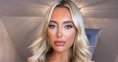 TOWIE's Amber Turner looks completely different without lip fillers in throwback snap - www.ok.co.uk