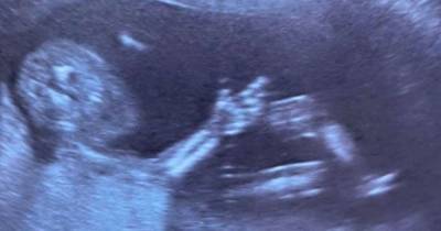 'You sure that's a baby and not an adult watching Netflix in your womb' - friends can't get over mum's baby scan picture - www.manchestereveningnews.co.uk - Manchester