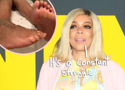 Wendy Williams Gives Update On Lymphedema Disease With SUPER Swollen Feet Pic! - perezhilton.com