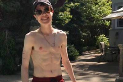 Elliot Page receives praise from fans and celebs after sharing bare-chested image after surgery - www.msn.com