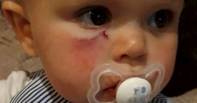 Toddler rushed to hospital after being mauled in the face by dog in unprovoked attack - www.dailyrecord.co.uk