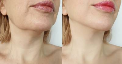 Fight Wrinkles and Sagging Skin With This Neck Firming Lift - www.usmagazine.com