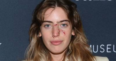 Ewan McGregor's daughter Clara bitten on face by dog before red carpet event - www.dailyrecord.co.uk - Las Vegas