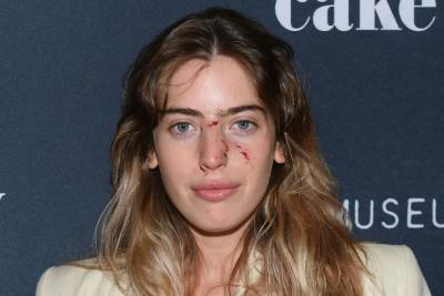 Ewan McGregor’s Daughter Clara Attends Red Carpet Premiere Sporting Injuries From Dog Bite To The Face - etcanada.com