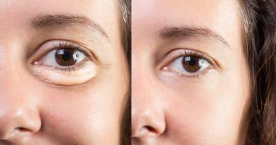 This Moisturizing Eye Cream May Dramatically Reduce Puffiness - www.usmagazine.com