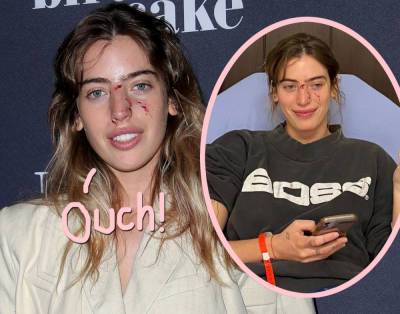 Ewan McGregor’s Daughter Attends Film Premiere Half Hour After Getting Attacked By A Dog -- See The Pics! - perezhilton.com