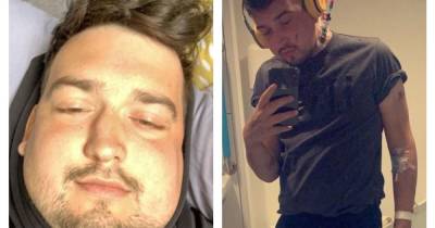 Fit and healthy man, 25, ballooned from 11 to 20 stone in just four weeks after contracting rare disease - www.manchestereveningnews.co.uk