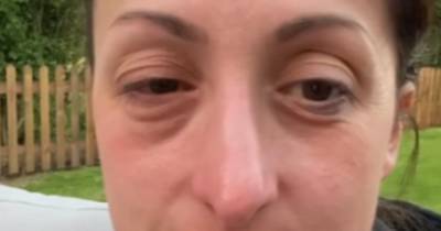 EastEnders’ Natalie Cassidy barely able to open eyes as she battles hay fever - www.ok.co.uk - Britain
