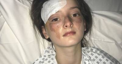 Schoolgirl left with horrific facial burns after poached egg explodes in her face - www.dailyrecord.co.uk - Manchester