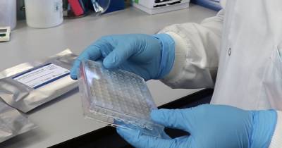 New coronavirus antibody tests with nearly 100% accuracy created by Scottish university - www.dailyrecord.co.uk - Scotland