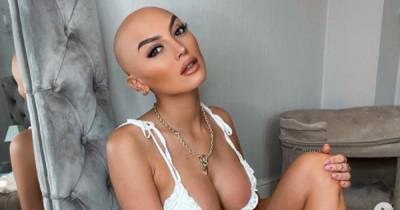 Ex On The Beach's ZaraLena Jackson opens up on her alopecia journey during a pandemic - ok.co.uk